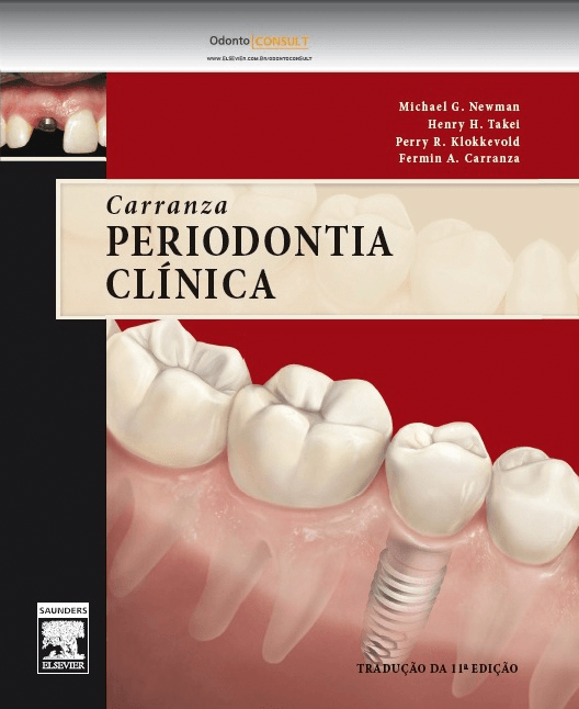 Carranza Periodontia Clinica 11ª Ed 12 Saraiva