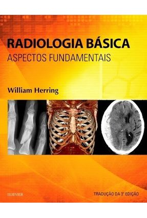 Radiologia Básica - Aspectos Fundamentais - Herring,William | 