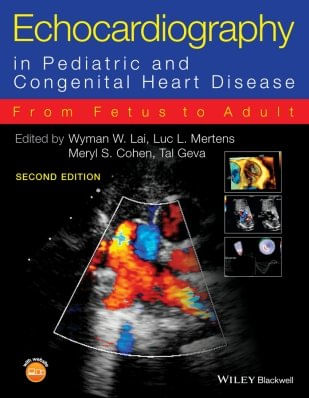 Echocardiography In Pediatric And Congenital Heart Disease From Fetus To Adult Saraiva Echocardiography In Pediatric And Congenital Heart Disease From Fetus To Adult Saraiva