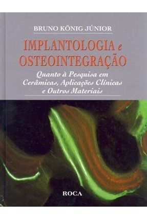 Implantologia e Osteointegração - Júnior,Bruno König | 