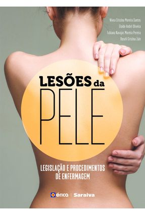 Lesões Da Pele - Nivea Cristina Moreira Santos | 