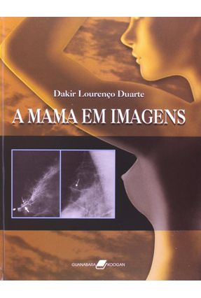A Mama em Imagens - Duarte,Dakir | 