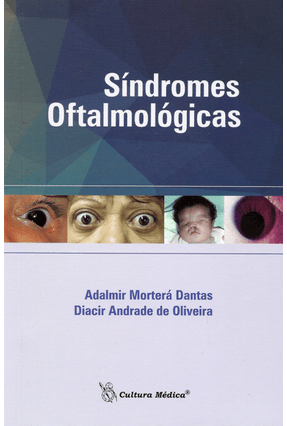 Síndromes Oftalmológicas - Dantas,Adalmir Mortera Oliveira,Diacir Andrade De | 