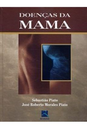 Doenças da Mama - Piato,José Roberto Morales Piato,Sebastiao | 