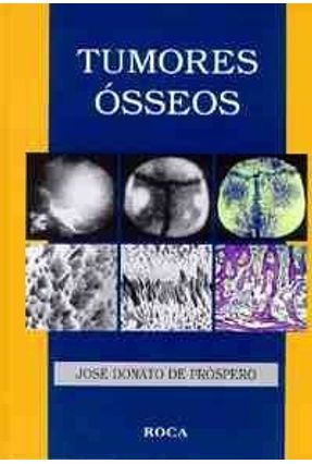 Tumores Osseos - Prospero,Jose Donato de | Nisrs.org