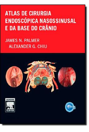 Atlas de Cirurgia Endoscopica Nasossinusal - Palmer,James | 