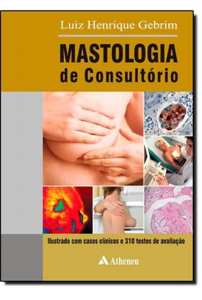 Mastologia de Consultório - Henrique Gebrim,Luiz | 