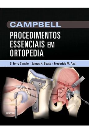 Campbell - Procedimentos Essenciais Em Ortopedia - Canale,S. Terry | Nisrs.org