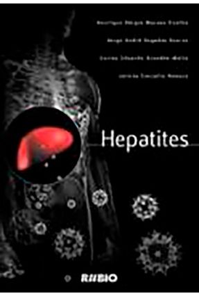Hepatites - Coelho,Henrique Sérgio Moraes Soares,Jorge André Segadas Brandão-Mello,Carlos Eduardo | 