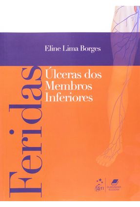 Feridas - Úlceras de Membros Inferiores - Borges,Eline Lima | 